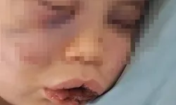 Vahşeti yaşayan 2 yaşındaki bebek hastanelik oldu
