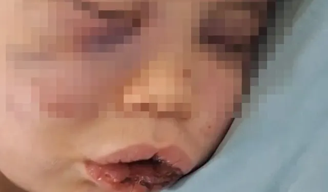 Vahşeti yaşayan 2 yaşındaki bebek hastanelik oldu