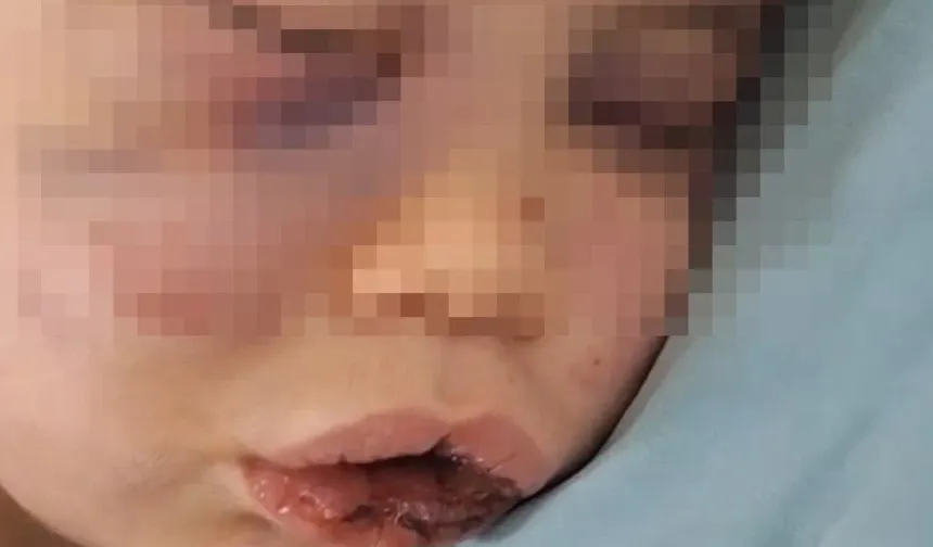 Vahşeti yaşayan 2 yaşındaki bebek hastanelik oldu