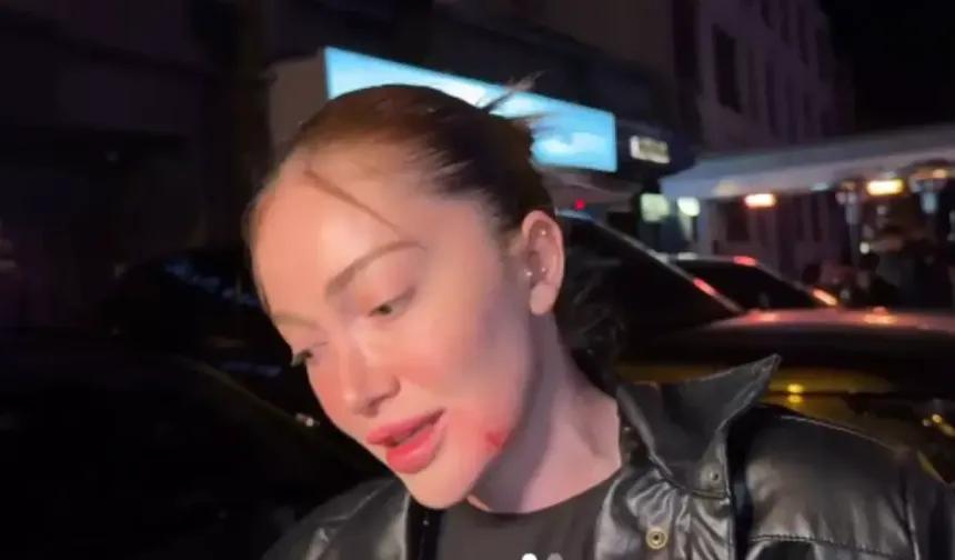 Danla Biliç'i darbeden eski sevgiliye 5 ay hapis cezası