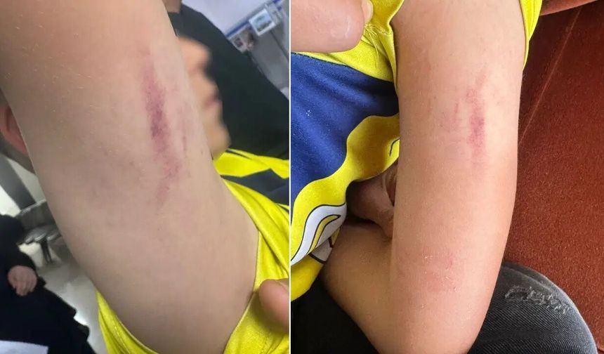 10 yaşındaki öğrenciye darp iddiası: Aile şikayetçi